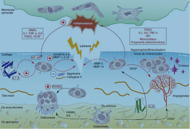 Schematische voorstelling van vicieuze cirkels bij knieartrose